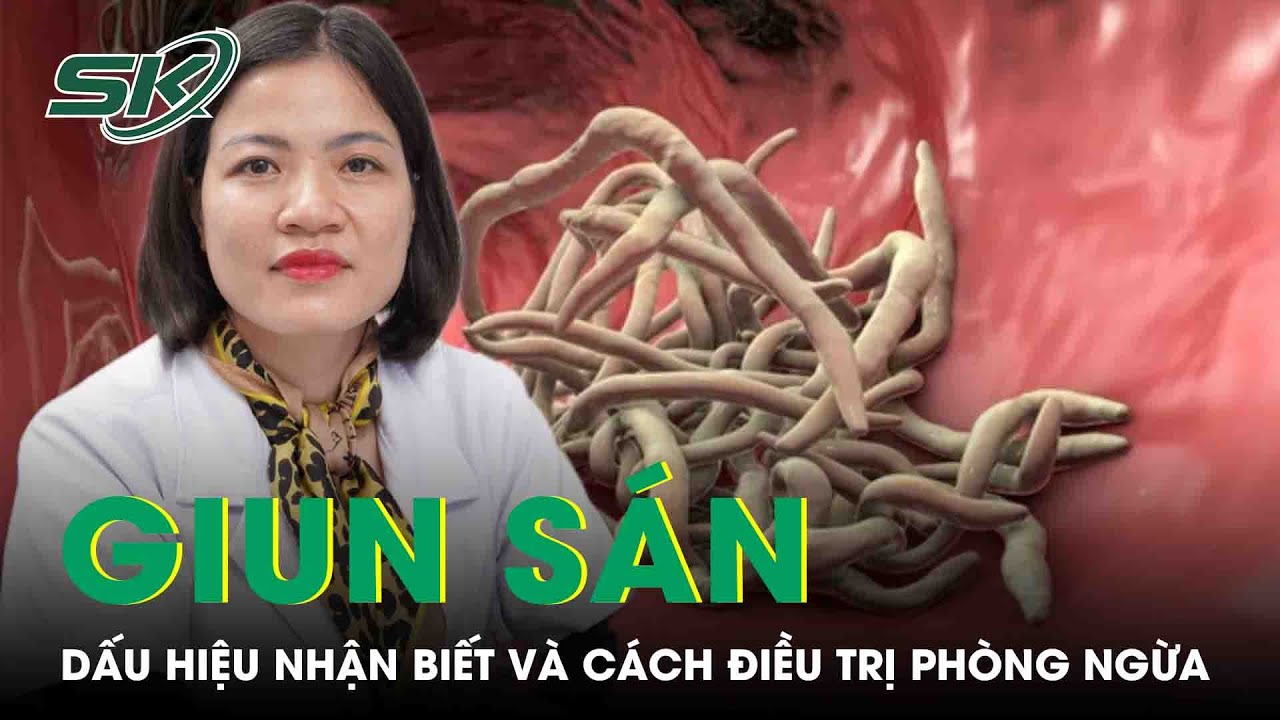 Giun Sán: Dấu Hiệu Nhận Biết Và Cách Điều Trị Phòng Ngừa | SKĐS - YouTube