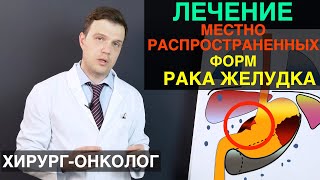 Рак желудка - лечение местно распространенных форм