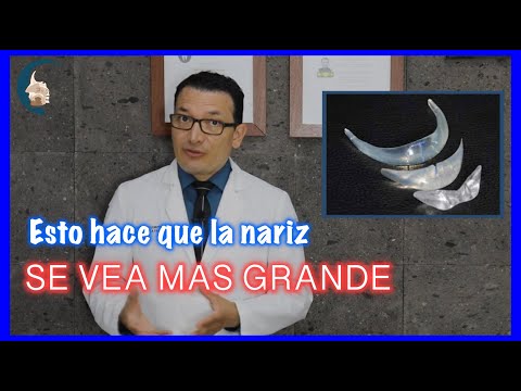 Video: ¿Quién realiza la genioplastia deslizante?