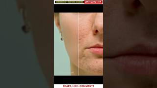 Get FLAWLESS Skin with Photoshop Retouching!