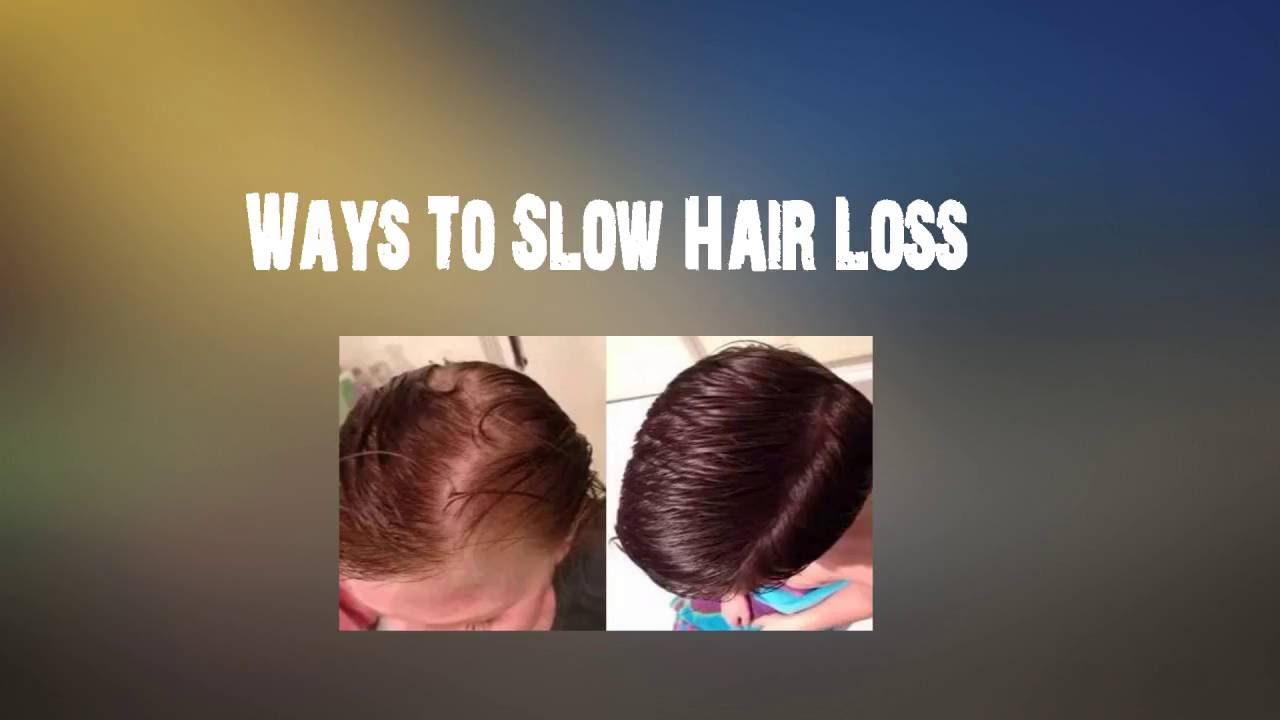 Ways To Slow Hair Loss
