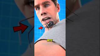 Why You Should Never Squeeze a Spider Bite