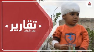 الضالع .. سكان ريف قعطبة هدف لقناصة مليشيا الحوثي