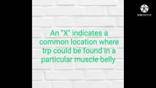 Sternalis, Pectoralis Majortrigger Points & Referral Patterntrailguide