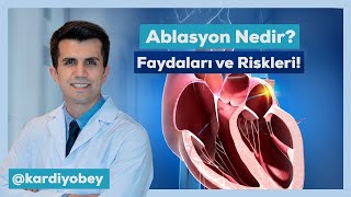 Ritim Bozukluğunun İlaçsız Tedavisi Ablasyon