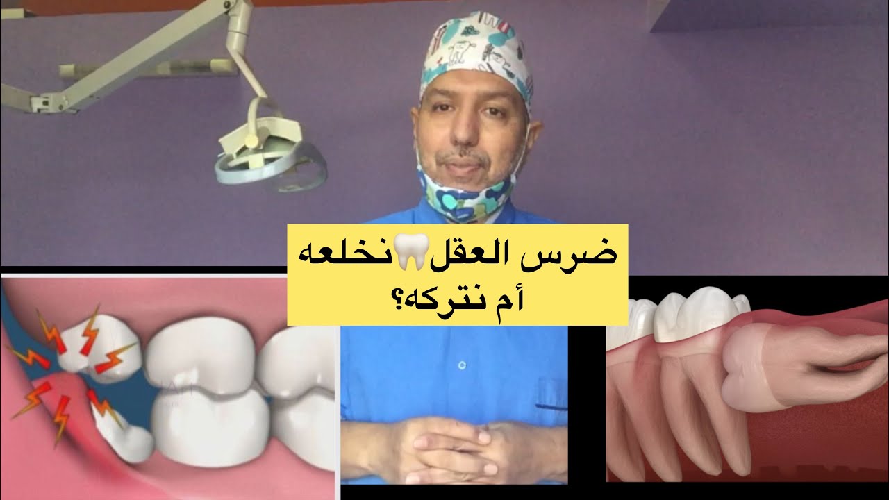 كل ما تود معرفته عن ضرس العقل 🦷 - YouTube