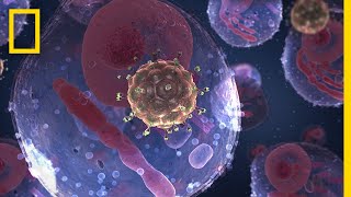 National Geographic: HIV and AIDS thumbnail