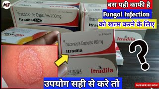 Cap-Itraconazole100mg/200mg/400mg |Best Medicine For Fungal infection| MedicalJankari