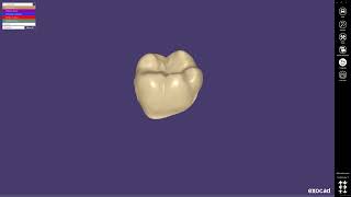 exocad Provisional Module