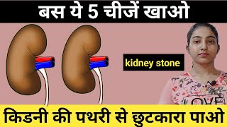 Kidney stone causes, symptoms and treatment in hindi|Alka Thakur|