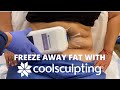 Freeze Away Fat with CoolSculpting | La Jolla Laser