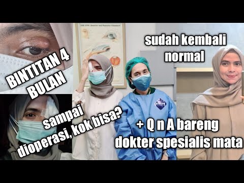 4 bulan mata bintitan akhirnya dioperasi | cara menghilangkan bintitan