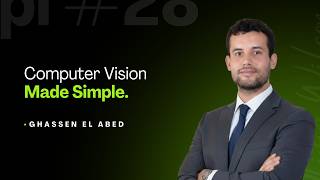 Convolutional Neural Networks (CNN) Explained | Computer Vision for Beginners
