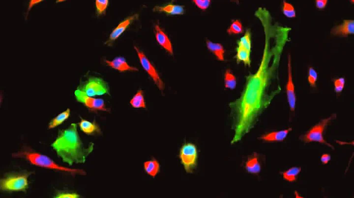 Time Lapse Imaging of HeLa Cells Treated With Latrunculin A
