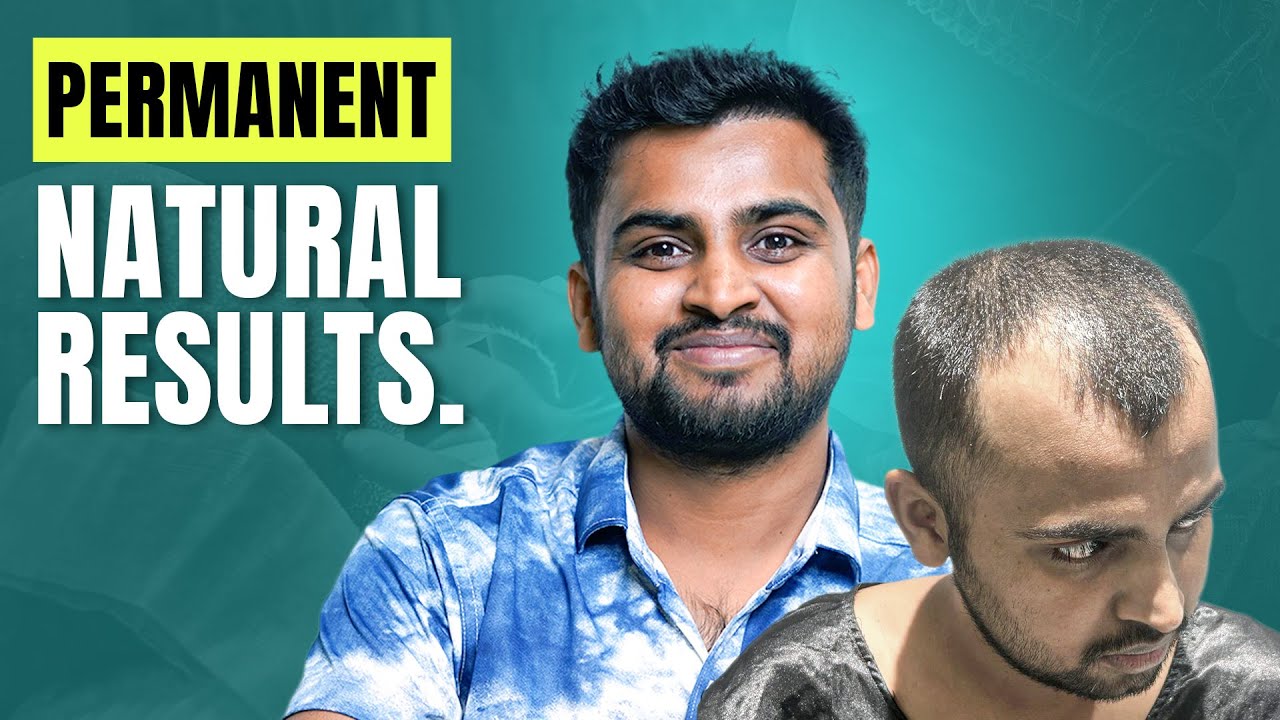 Natural Hair Transformation in Kolkata 😍 | Grade 4 Baldness | Cost & Results | New Roots