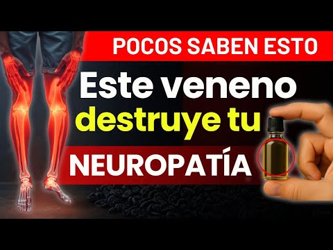 Tienes Neuropatía Y