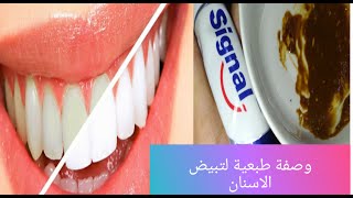 تبيض الأسنان بوصفة منزلية سهلة وبسيطة مكونات موجودة في البيت/