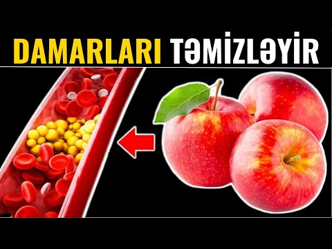 Bu Qidaları Yeyən Kimi Damarlar Açılır!