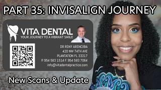 PART 35: INVISALIGN UPDATE - NEW SCANS & BREAKDOWN OF MY JOURNEY