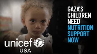 Anak-anak Gaza Butuh Dukungan Gizi Sekarang