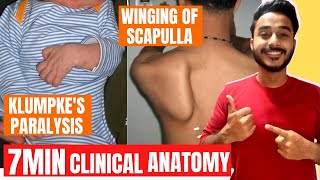 klumpkes paralysis clinical anatomy of brachial plexus | winging of scapula clinical anatomy