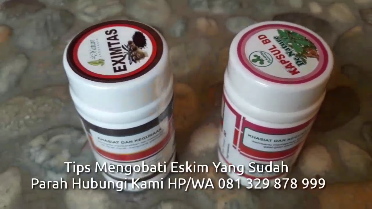 cara menyembuhkan penyakit kulit eksim 