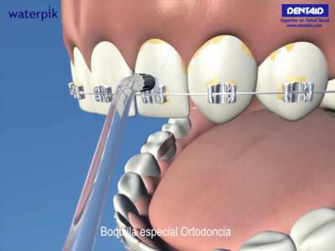 Tu higiene bucal diaria: Ortodoncia