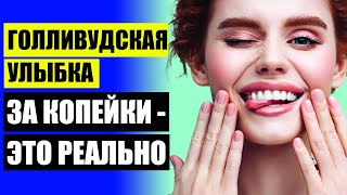 Керамические виниры преимущества ? Виниры на рефракторе этапы