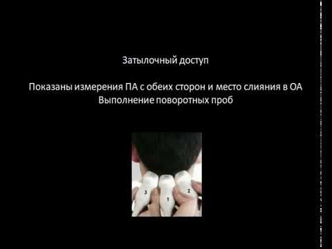 Технология исследования интракраниальных брахиоцефальных сосудов