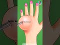 ASMR Infected Hand Treatment Animation | #reels #asmr #handtreatment  #odlysatisfying