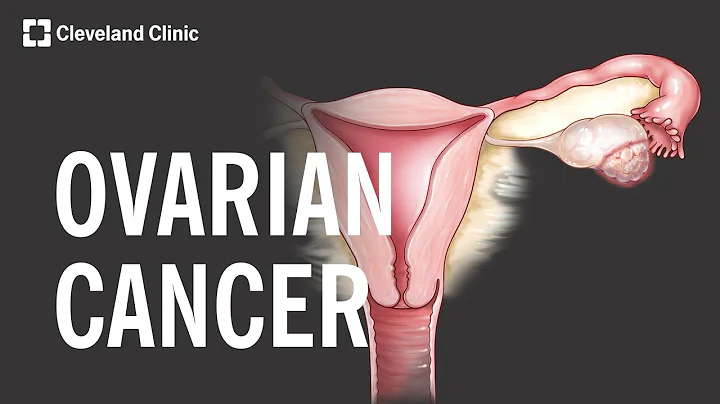 5 Warning Signs and Risk Factors of Ovarian Cancer - DayDayNews