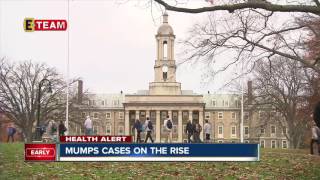 Mumps cases on the rise
