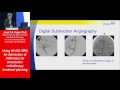 Using 4D ASL MRA for delineation of AVM nidus for stereotactic radiotherapy planning