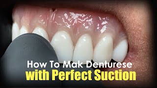 How to Make Dentures with Perfect Suction screenshot 3