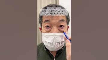 【クマ取り】爆弾クマを除去した結果・・・#shorts