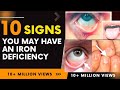 Top 10 Signs You May Have An Iron Deficiency | Iron deficiency anemia, all you need to know!