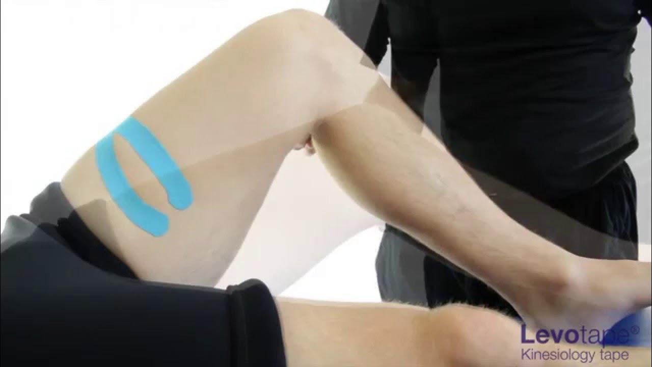 Levotape Kinesiology Tape fascial taping technique applied to the