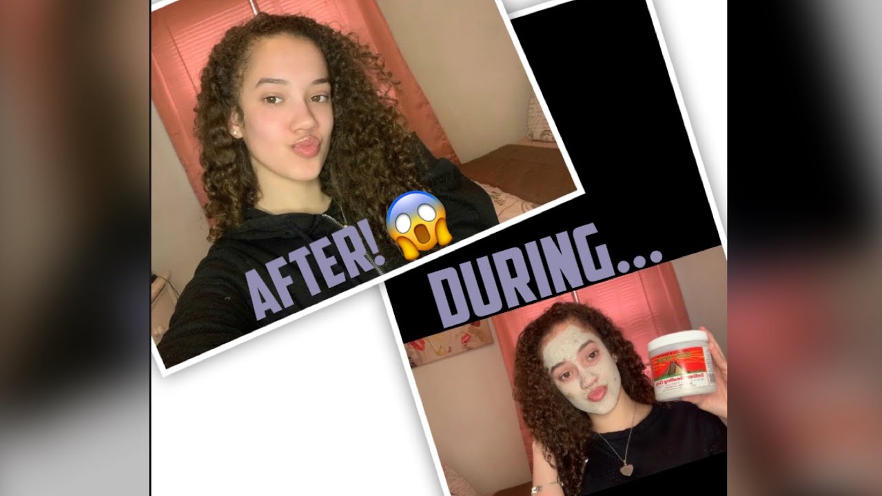 THE KEY TO CLEAR SKIN!! 🤫 | SABRYN AHLIYA