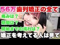 【永久保存版】総額56万円でマウスピース矯正を始めた時の全てをここに。【大人の矯正】