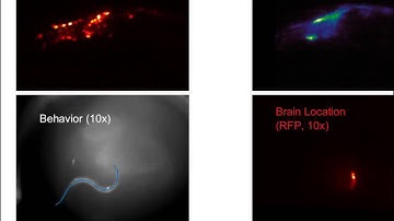 Imaging system tracks brain activity of a freely moving worm