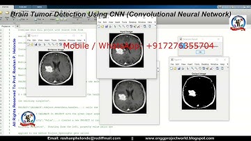 Brain Tumor Detection Using CNN Convolutional Neural Network | Brain Tumor Detection Using Matlab