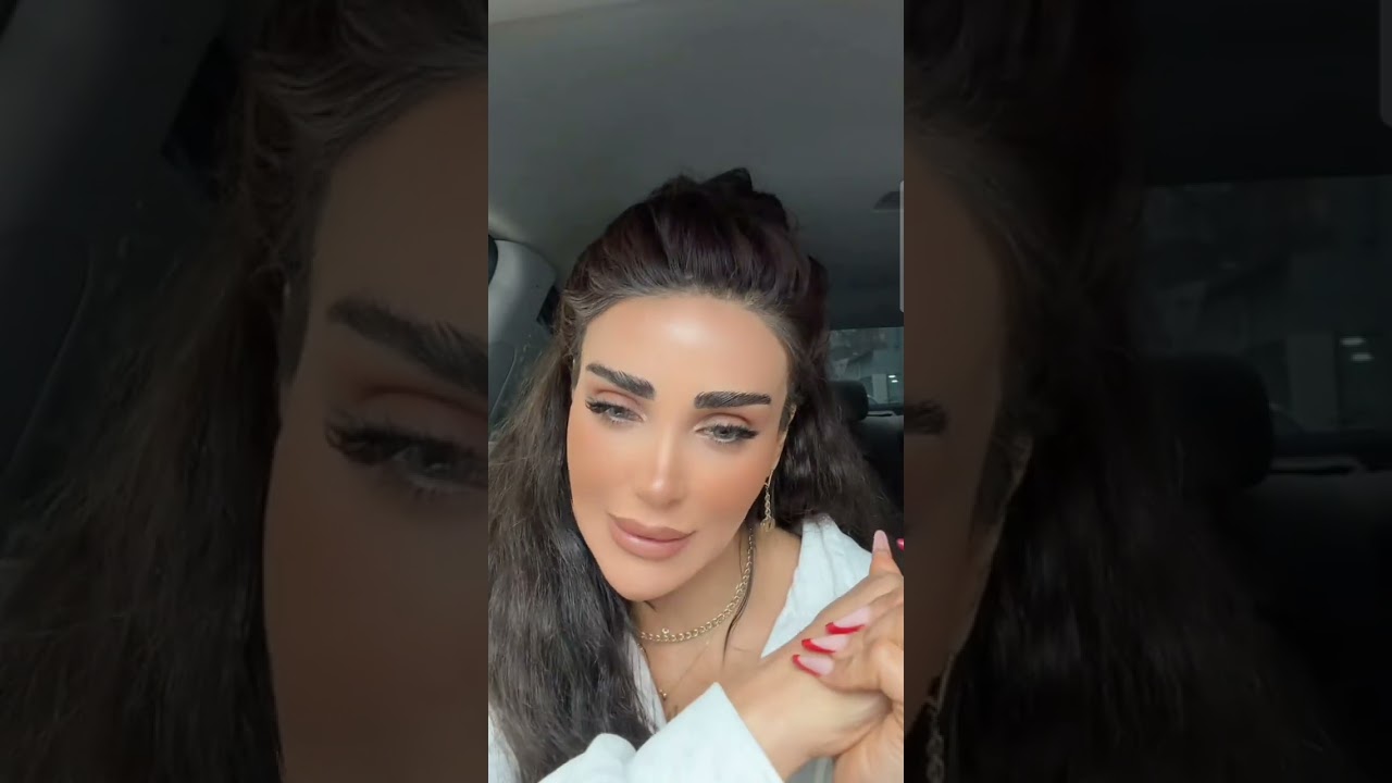 Nerminin üzündeki yenilikler gündem oldu.Estetik  prosedurlari bir-bir açıqladı.😵