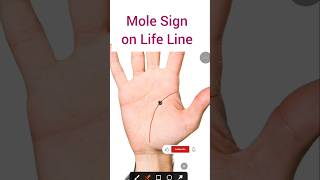 Mole Sign on Palm | Palmistry by ThePalmIQ | #palmistry #palmist