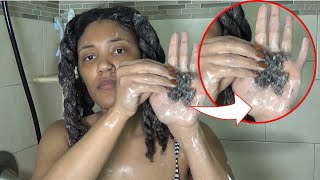 My Hair Was Matting at the Roots | Postpartum Shedding