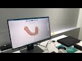 s6000 scanner intraoral fussen - Biotech ltda