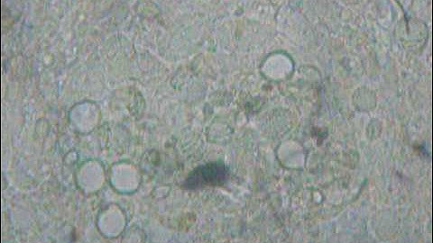 Coiled sting cell on a Jellyfish Tentacle