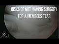 Risk of not having surgery for a meniscus tear