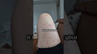맘은 청춘 앞서가는 몸 #망초대뽑기 #피부질환 #면역력  #허리통증