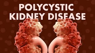 Study On Autosomal Dominant Polycystic Kidney Disease Among South Indians A Clinical Approach