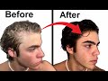 How to stop balding  full hair loss guide